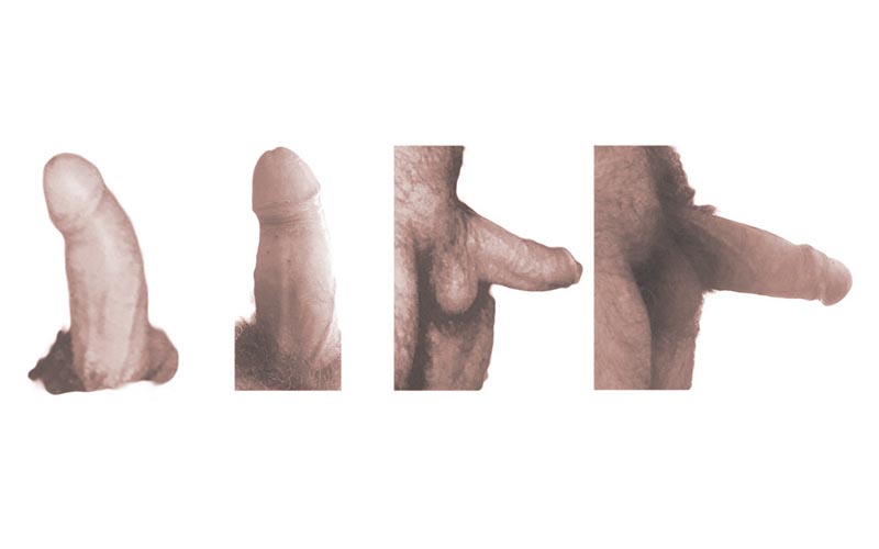 pene curvo caso 12